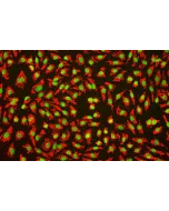 Human Umbilical Vein Endothelial Cells (HUVEC) – Immunofluorescence for vWF (Sigma-Aldrich Cat.#F3520), 200x.
