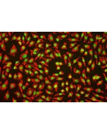 Human_Umbilical_Vein_Endothelial_Cells (HUVEC) – Immunofluorescence for vWF (Sigma-Aldrich Cat.#F3520), 200x.
