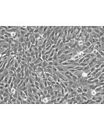 Human Vertebral Mesenchymal Stem Cells (HVMSC) - Phase contrast, 200x.