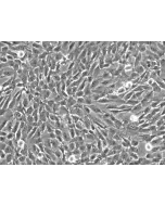 Human Vertebral Mesenchymal Stem Cells (HVMSC) - Phase contrast, 200x.
