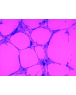 In Vitro Tube Formation Assay