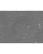 Mouse Cardiac Myocytes (MCF) - Phase contrast, 100x.