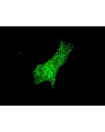 Mouse Cardiac Myocytes (MCM) – Immunostaining for Sarcomeric alpha-Actinin (Boster, Cat #MA1104)
