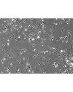 Mouse Dermal Fibroblasts (MDF)- Phase Contrast, 100x