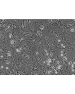 Mouse Hepatic Stellate Cells (MHSteC) - Phase contrast, 100x.
