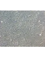 Mouse Lens Epithelial Cells (MLEpiC) - Phase Contrast, 100x