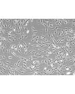 Mouse Lymphatic Fibroblasts (MLF) - Phase Contrast