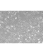 Mouse Lymphatic Fibroblasts (MLF) – Phase Contrast, 100x
