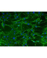 Mouse Lymphatic Fibroblasts (MLF) - Immunostaining for Fibronectin, 200x