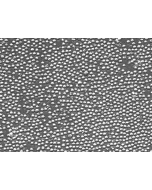 Mouse Lymphatic Mononuclear Cells (MLMC) – Relief Contrast, 200x
