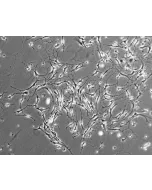 Mouse Neurons-striatal (MN-s) - Phase contrast, 100x.
