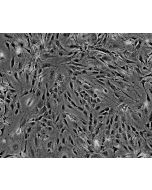 Mouse Perineurial Fibroblasts (MPNF) - Phase contrast, 100x.