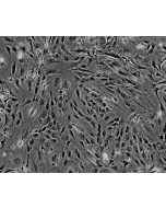 Mouse Perineurial Fibroblasts (MPNF) - Phase contrast, 100x.
