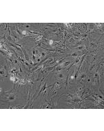Mouse Renal Mesangial Cells (MRMC) - Phase contrast, 100x.
