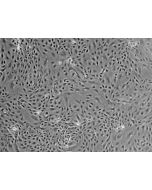 Mouse Renal Proximal Tubular Epithelial Cells (MRPTEpiC) - Phase contrast, 100x.