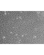 Mouse Renal Proximal Tubular Epithelial Cells (MRPTEpiC) - Phase contrast, 100x.
