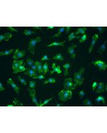 Mouse Splenic Macrophages (MSMa) - Immunostaining for CD11b, 400x