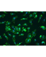 Mouse Splenic Macrophages (MSMa) – Immunostaining for CD11b, 400x
