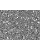 Rabbit Astrocytes (RabA) – Phase Contrast, 100X.
