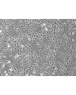 Rabbit Dermal Fibroblasts (RabDF) – Phase Contrast, 100X.
