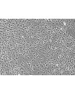 Rat Astrocytes-adult - Phase Contrast, 100x