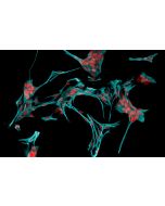 Rat Astrocytes-cerebellar (RA-h) - Immunostaining for GFAP
