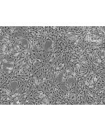 Rat Astrocytes (RA) - Phase contrast, 100x.