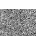 Rat Astrocytes (RA) - Phase contrast, 100x.
