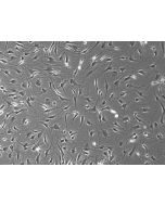 Rat Dermal Fibroblasts-adult  (RDF-a) - Phase Contrast, 100x.