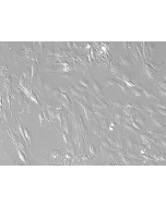 Rat Hepatic Stellate Cells-adult (RHSteC-a)-Relief contrast, 200x.
