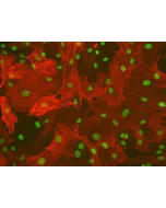 Rat Hepatic Stellate Cells (RHSteC) - Immunostaining for α-SMA, 200x.
