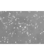 Rat Neurons-hippocampal (RN-h) - Phase contrast, 200x.
