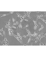 Rat Schwann Cells (RSC) - Phase contrast, 200x.
