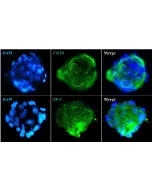 Immunostaining of the human pulmonary alveolar epithelial cell spheroids with the epithelial cell marker CK18 and the specific alveolar epithelial cell type II marker SP-C. 