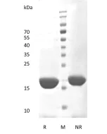 Recombinant Human Interleukin-6