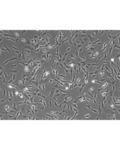 人类视网膜星形胶质细胞（HRA）- 相差显微镜，100倍放大。