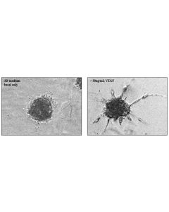 Collagen-embedded HUVEC spheroids at 24 hours post VEGF-stimulation