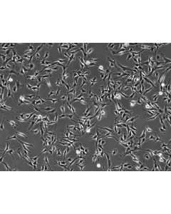 Bovine Dermal Fibroblasts (BDF)-Phase contrast, 100x