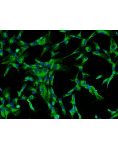 Bovine Lens Epithelial Cells (BLEpiC)-Immunostaining for CK-18, 200X.