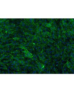 Bovine Meningeal Cells (BMC)-Immunostaining for FN, 200X