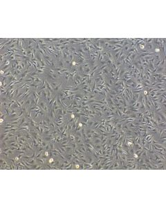 Bovine Oral Fibroblasts (BOF) - Phase Contrast, 100X