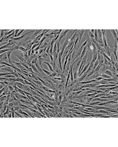 Dog Mesenchymal Stem Cells-adipose (DMSC-ad) - Phase contrast, 200x.
