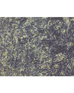 HPSC-derived Cardiomyocytes