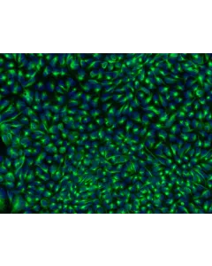 HPSC-Derived Neural Stem Cells (H9-NSC) – Immunostaining for Nestin, 200x