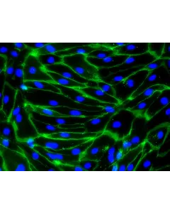 HiPSC-Derived Endothelial Cells (HiPSC-EC) -
Immunostaining for CD31, 200x
