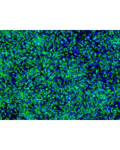 HiPSC-Derived Neural Stem Cells (HiPSC-NSC) - Immunostaining for Nestin, 200x
