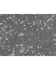 Horse Mesenchymal Stem Cells-adipose (HNSC-ad) - Phase Contrast 100X