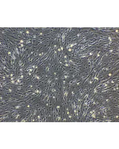 hPSC-Derived Endothelial Cells (hPSC-EC) - Phase contrast, 100x