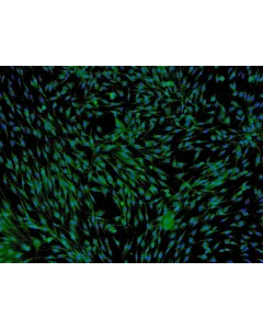 Human Adipose-derived Mesenchymal Stem Cells (HMSC-ad) - Immunostaining for CD73, 100x.