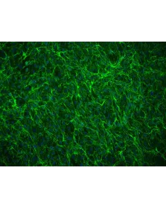 Human Annulus Fibrosus Cells (HAFC) - Immunostaining for Fibronectin, 200x.
